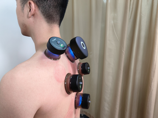 Fitdash スマート マッサージ カップリング バキュム カップリング 療法 装置 ボタン制御