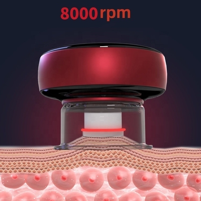 Fitdash Cuppers カップリング フィジオテラピー ツール カップリング 医療機器 健康改善