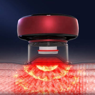 Fitdash Cuppers カップリング フィジオテラピー ツール カップリング 医療機器 健康改善